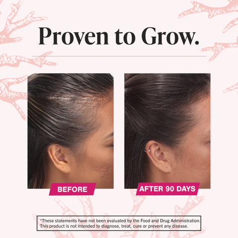 Hair Growth Support Supplement for Women – Thicker, Fuller-Looking Hair Formula (180 Tablets, Max Strength)